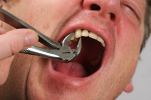 tooth-extraction-orange-county-tips1-300x199